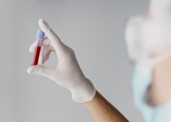 La Ceja: tras jornada masiva de muestras, se dispararon casos activos de Covid.